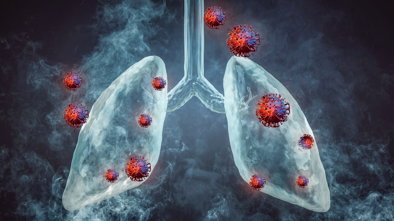 Đông trùng hạ thảo giúp đẩy lùi tế bào ung thư phổi