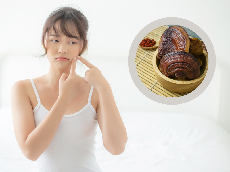 nấm linh chi trị mụn có hiệu quả không top 5 loại nấm trị mụn đẹp da