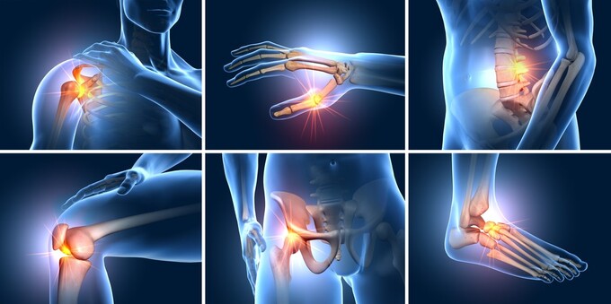 Tác dụng của sụn vi cá mập - Chữa bệnh xương khớp